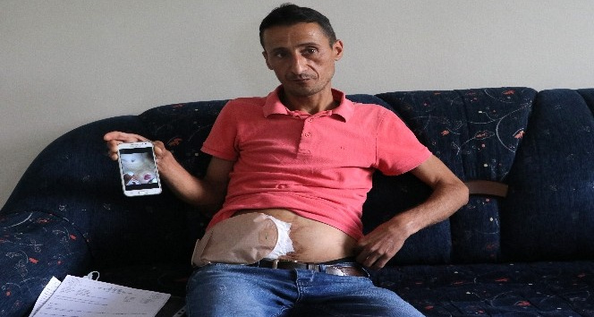 Bağırsakları vücudunun dışında olan adam yardım bekliyor